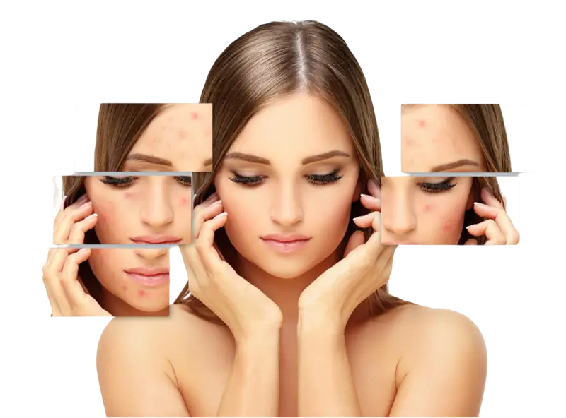 Skin Treament Kurnool